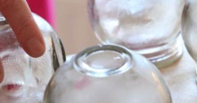 Cupping therapy workshops in Ireland